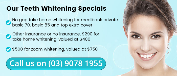 Our Teeth Whitening Specials Banner | Dentist Melbourne