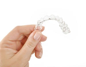 The Benefits of Straightening Teeth with Clear Braces