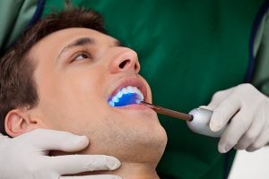 Timelines And Tooth Bonding A Great Match melbourne dentist