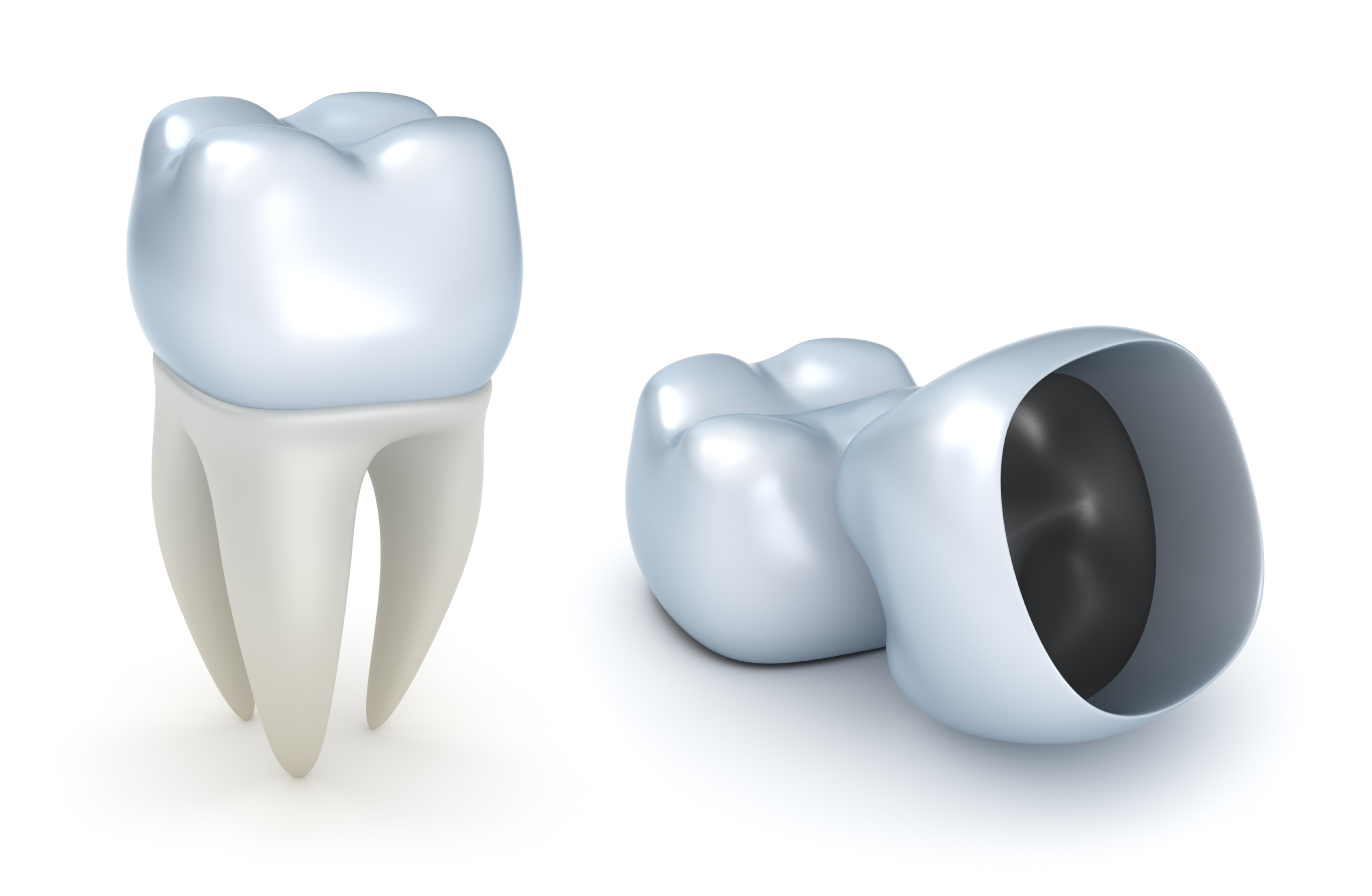 Why Consider Dental Crowns to Restore Your Smile