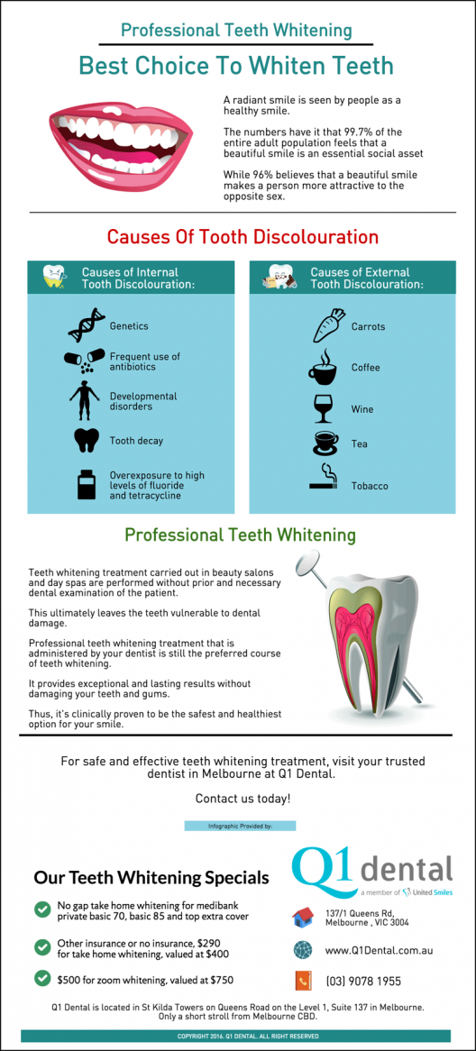 Professional-Teeth-Whitening-in-Melbourne-Best-Choice-To-Whiten-Teeth