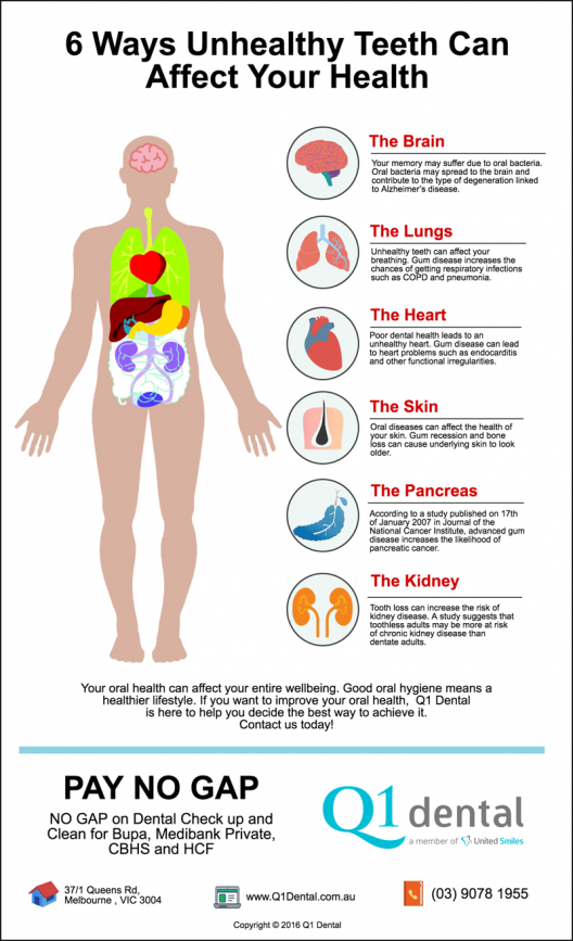 Melbourne Dentist Trivia: 6 Ways Unhealthy Teeth Can Affect Your Health