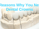 melbourne-dentist-tips-5-reasons-why-you-need-dental-crowns