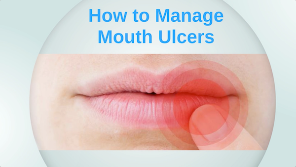 melbourne-dentist-advice-how-to-manage-mouth-ulcers