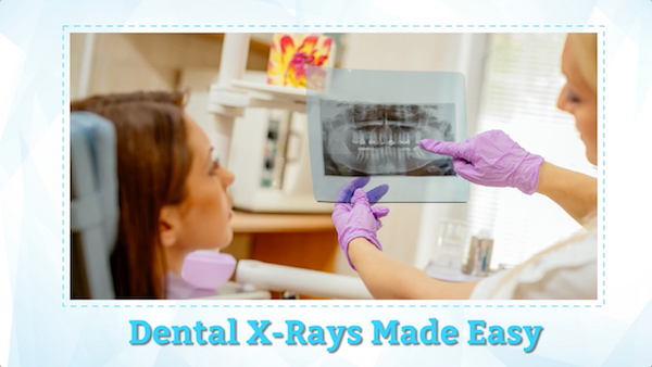 Dental X-rays How Does It Work