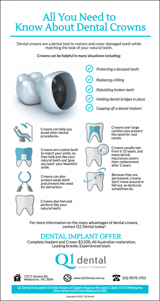 Dental-Crowns-Everything-You-Need-to-Know-About@2x Dental Crowns: Everything You Need to Know About
