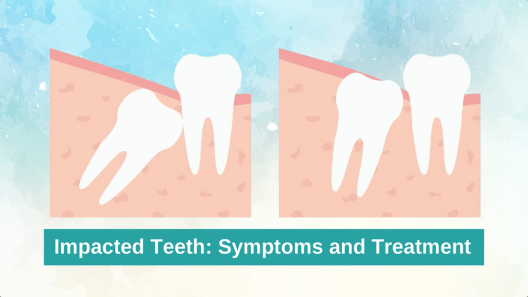 What are the Warning Signs of Impacted Teeth